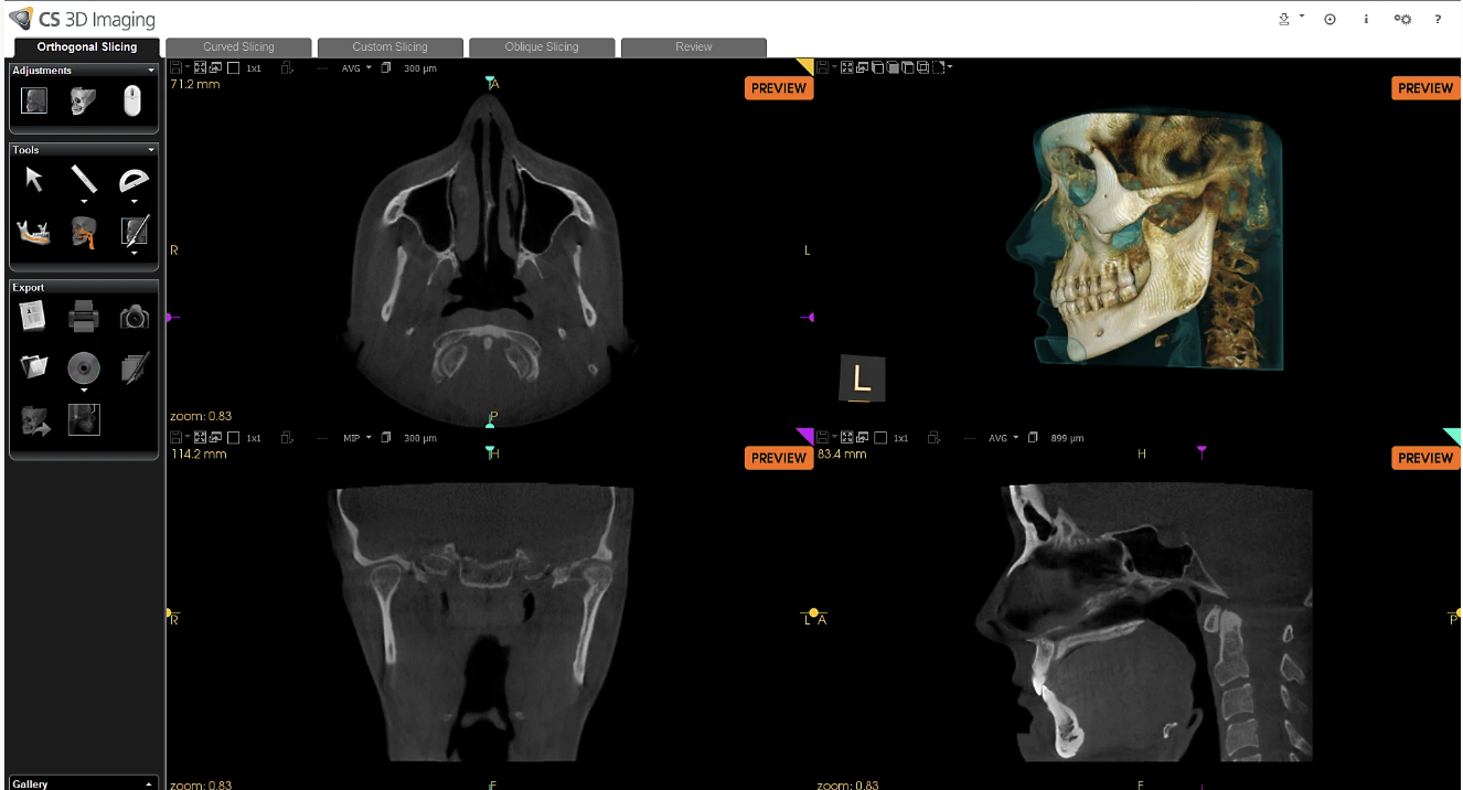 CBCT & OPG Repair